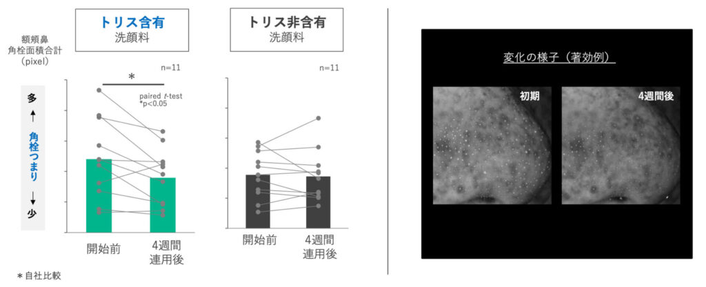 トリスの角栓への効果