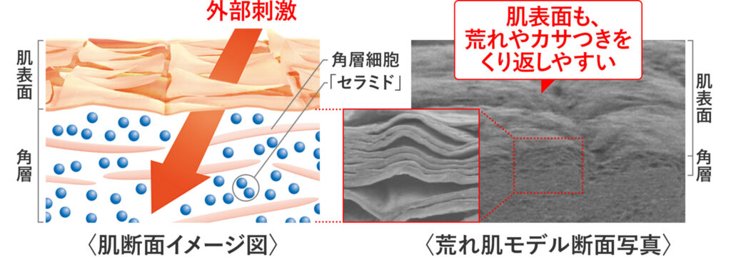 セラミド不足の肌の状態